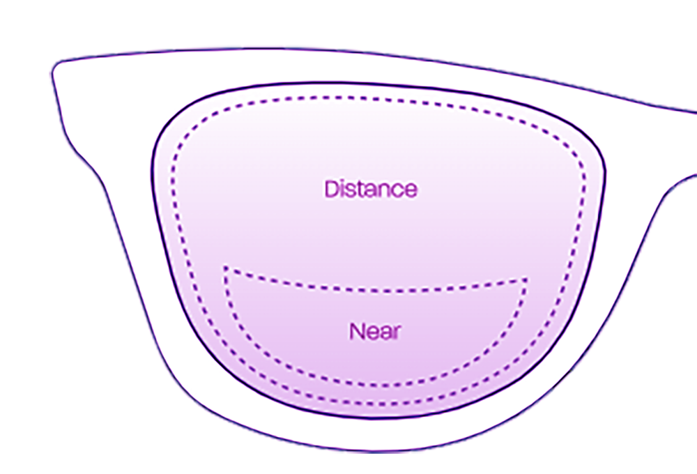 About Bifocal